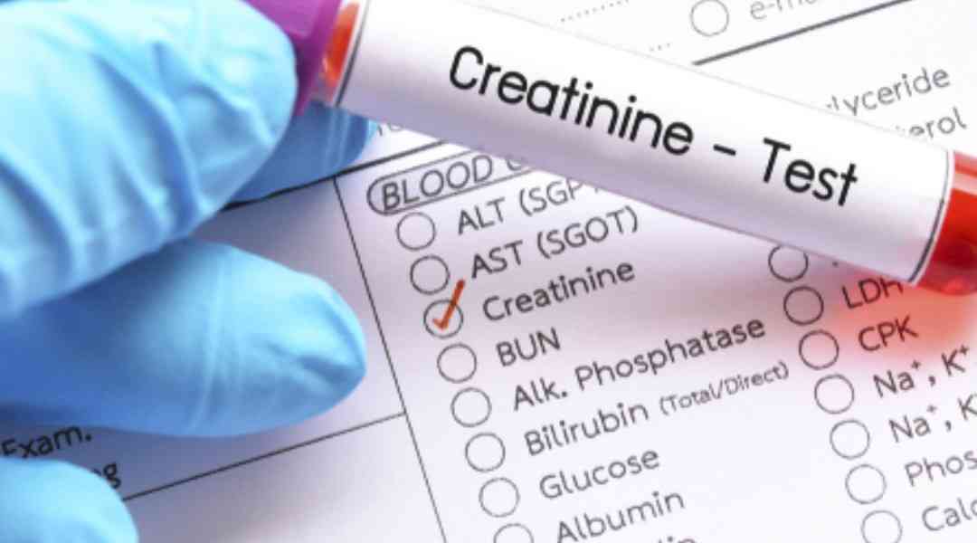 κρεατινίνη, τιμες, creatinine, υψηλά επίπεδα κρεατινίνης, που οφείλονται τα υψηλά επίπεδα κρεατινίνης, πως μπορούν να μειωθούν τα επίπεδα της κρεατινίνης