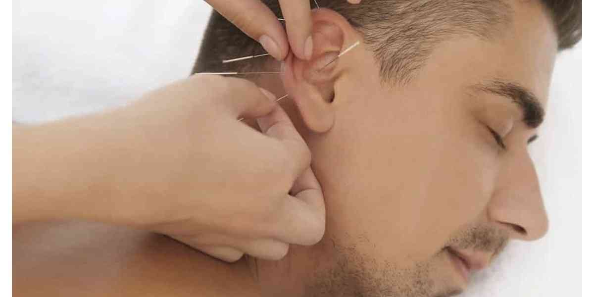 Άγχος, Βελονισμός, Θεραπεία του άγχους με βελονισμό