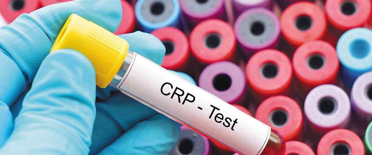 CRP, Τι είναι, Τιμές CRP, Τι μας δείχνει, ΨΡΠ, Καρκίνος, Έχω αυξημένη CRP, CRO τιμές σε καρκίνο
