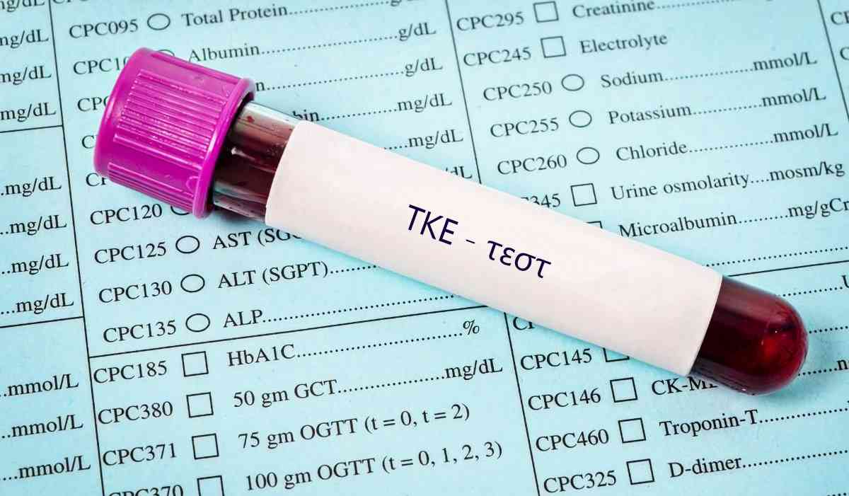 ΤΚΕ τι είναι, ΤΚΕ τιμές, Τι μας δείχνει η ΤΚΕ, TKE, Ταχύτητα καθίζησης ερυθρών, Erythrocyte Sedimentation Rate, ESR, Φυσιολογική τιμή ΤΚΕ