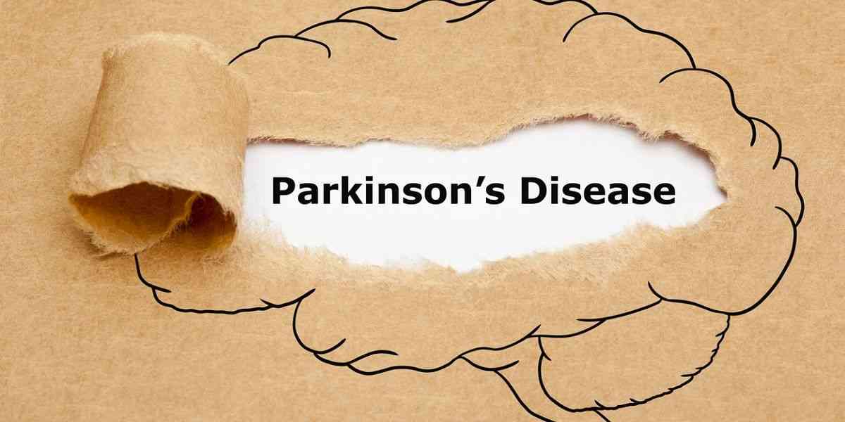 Πάρκινσον, Νόσος Parkinson, Συμπτώματα, Αιτίες, Θεραπεία, Αντιμετώπιση