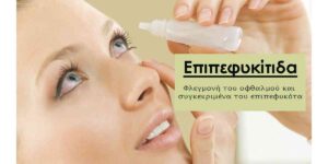 Επιπεφυκίτιδα