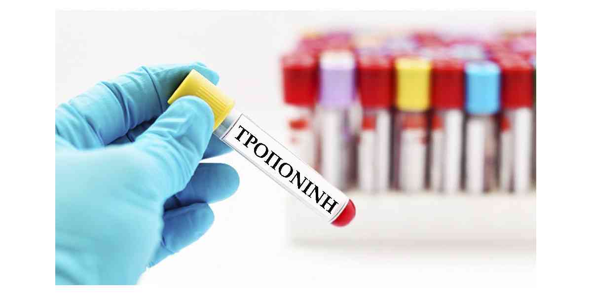 τροπονίνη, εξέταση τροπονίνης, τεστ τροπονίνης, τι είναι η τροπονίνη, φυσιολογικές τιμές τροπονίνης, υψηλά επίπεδα τροπονίνης, τι δείχνει η εξέταση τροπονίνης, τροπονίνη και έμφραγμα