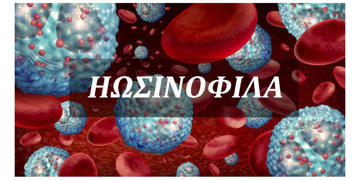 Ηωσινόφιλα, Υψηλά ηωσινόφιλα, Χαμηλά ηωσινόφιλα, Ηωσινοφιλία, Αιτίες ηωσινοφιλίας, Θεραπεία, Αντιμετώπιση