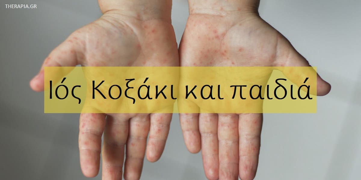Ιός κοξάκι και παιδιά, Κοξάκι, Ιός κοξάκι, Τύποι ιού κοξάκι, Συμπτώματα κοξάκι στα παιδιά, Θεραπεία κοξάκι, Διάγνωση ιού κοξάκι, Πόσο κρατά η λοίμωξη με κοξάκι