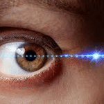 EMDR