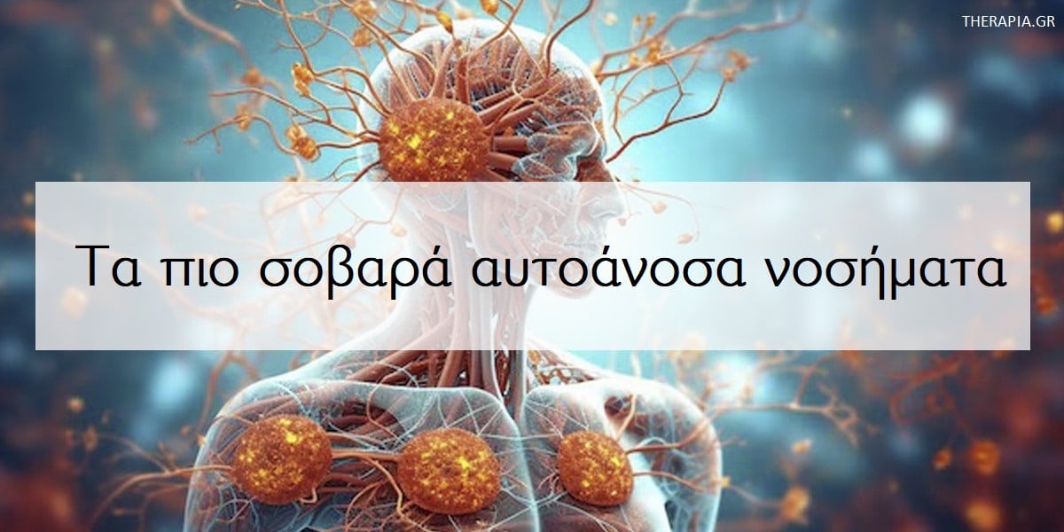 Τα πιο σοβαρά αυτοάνοσα νοσήματα, Αυτοάνοσα νοσήματα, Μπορεί τα αυτοάνοσα να είναι απειλητικά για τη ζωή, Αυτοάνοσα νοσήματα απειλητικά για τη ζωή, Στρες και αυτοάνοσα νοσήματα