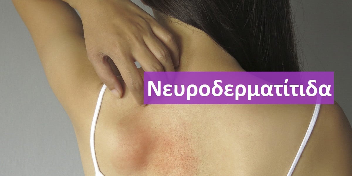 Νευροδερματίτιδα, Νευροδερματίτιδα εικόνες, Νευροδερματίτιδα φωτογραφίες