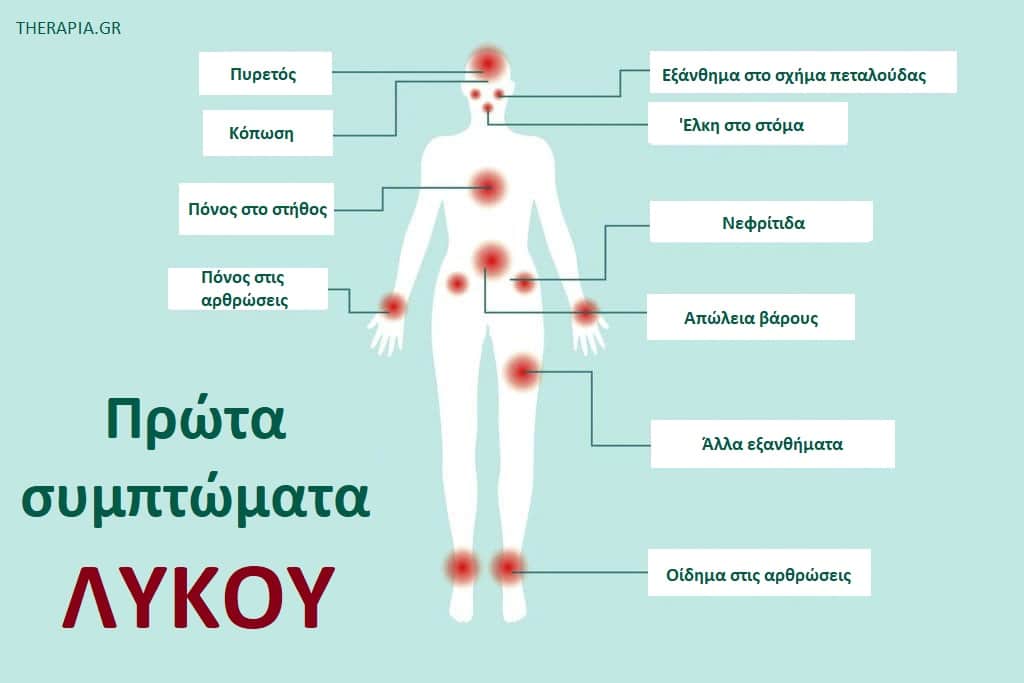 Συμπτώματα λύκου, Λύκος. Πρώτα σημάδια λύκου
