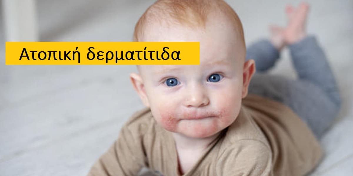 Ατοπική δερματίτιδα φωτογραφίες, Αιτίες ατοπικής δερματίτιδας, Διάγνωση ατοπικής δερματίτιδας