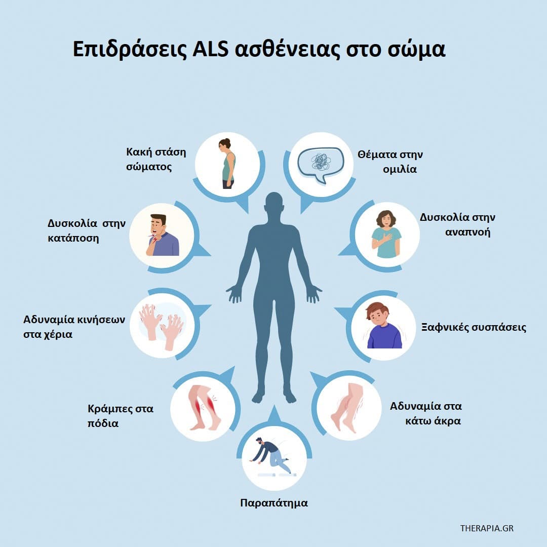 ALS ασθένεια, ALS ασθένεια προσδόκιμο ζωής, ALS ασθένεια αιτίες