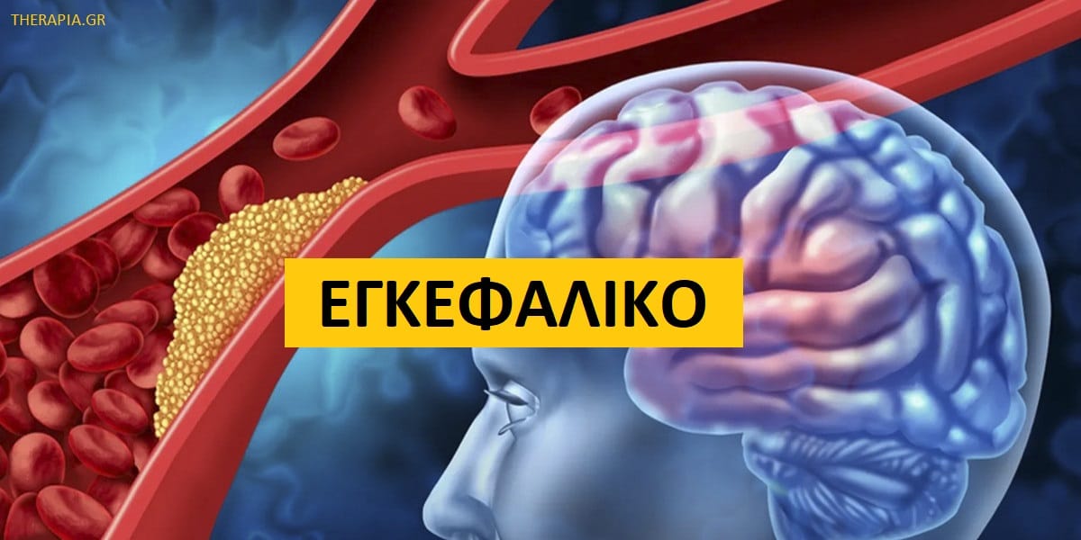 Εγκεφαλικό, Τύποι εγκεφαλικού, Τι συμβαίνει στο εγκεφαλικό, Βλάβες μετά από εγκεφαλικό, Ανάρρωση μετά από ένα εγκεφαλικό επεισόδιο, Πρόληψη εγκεφαλικού επεισοδίου
