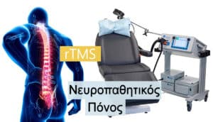rTMS και Νευροπαθητικός πόνος