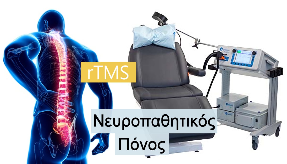 rTMS, Νευροπαθητικός πόνος, ΡΤΜΣ, Αποτελέσματα, Αποτελεσματικότητα