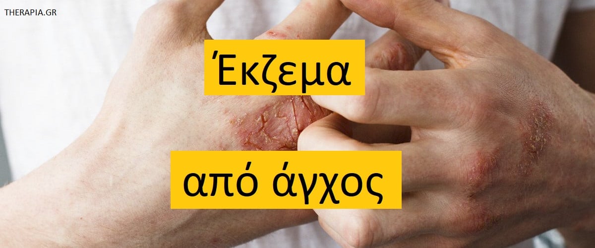 Έκζεμα από άγχος, Έκζεμα από άγχος συμπτώματα, Πως το στρες επηρεάζει το δέρμα, Σύνδεση άγχους εκζέματος, Συμπτώματα εκζέματος από άγχος, Συναισθηματική επίδραση εκζέματος, Σύνδεση εγκεφάλου δέρματος, Διάγνωση εκζέματος από άγχος, Αυτοεκτίμηση και έκζεμα, Ψυχολογικές επιδράσεις εκζέματος από άγχος, Αντιμετώπιση εκζέματος από άγχος