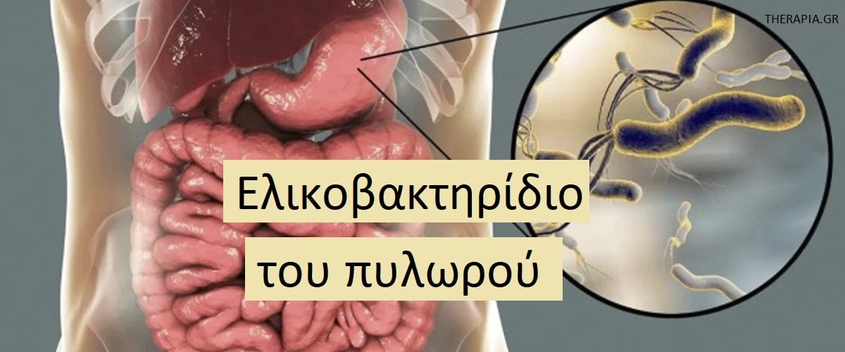 Ελικοβακτηρίδιο του πυλωρού, H. pylori, Συμπτώματα ελικοβακτηριδίου του πυλωρού, Αιτίες ελικοβακτηριδιου του πυλωρού, Παράγοντες κινδύνου για ελικοβακτηρίδιο του πυλωρού, Επιπλοκές ελικοβακτηριδίου του πυλωρού, Τροφές που βοηθούν στην αντιμετώπιση του ελικοβακτηριδίου του πυλωρού, Τροφές που πρέπει να αποφεύγετε στη λοίμωξη από ελικοβακτηριδιο του πυλωρού