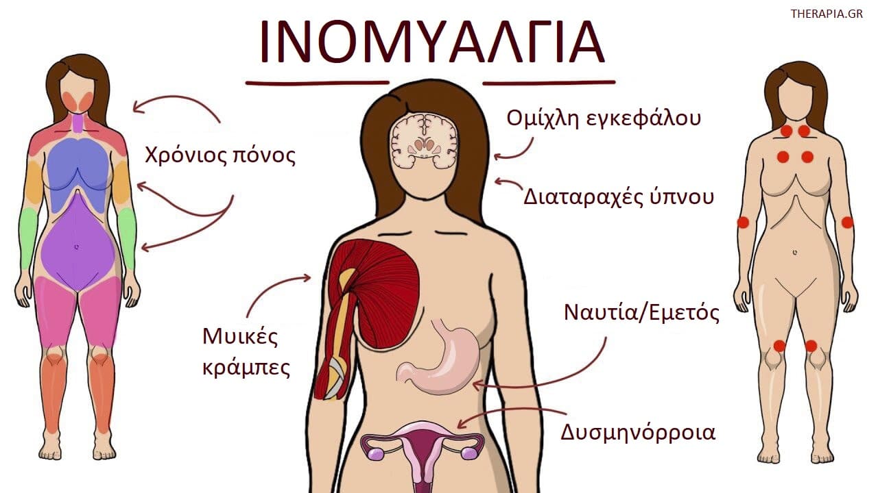 Ινομυαλγία, Συμπτώματα ινομυαλγίας, Διαχείριση ινομυαλγίας