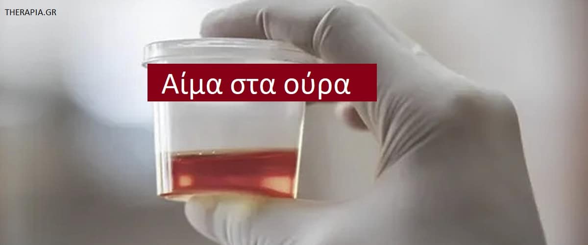 Αίμα στα ούρα, Εξέταση για αίμα στα ούρα, Πότε γίνεται η εξέταση για αίμα στα ούρα, Αυξημένες τιμές αίματος στα ούρα, Απουσία αίματος στα ουρά, φάρμακα που επηρεάζουν τα ούρα