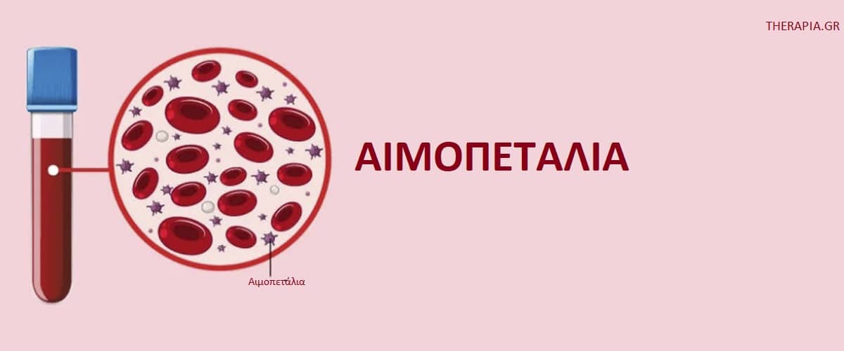 Αιμοπετάλια, Εξέταση αιμοπεταλίων, Πότε γίνεται η εξέταση αιμοπεταλίων, Πως γίνεται η εξέταση αιμοπεταλίων, Φυσιολογικές τιμές αιμοπεταλίων, Υψηλές τιμές αιμοπεταλίων, Χαμηλές τιμές αιμοπεταλίων, Φάρμακα που επηρεάζουν την εξέταση αιμοπεταλίων