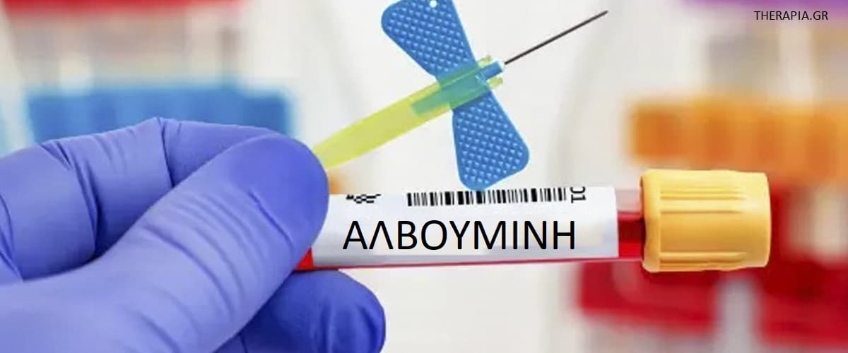 Αλβουμίνη, Εξέταση αλβουμίνης, Πώς γίνεται η εξέταση αλβουμίνης, Πότε γίνεται η εξέταση αλβουμίνης, Φυσιολογικές τιμές αλβουμίνης, Υψηλές τιμές αλβουμίνης, χαμηλές τιμές αλβουμίνης, Φάρμακα που επηρεάζουν την εξέταση αλβουμίνης