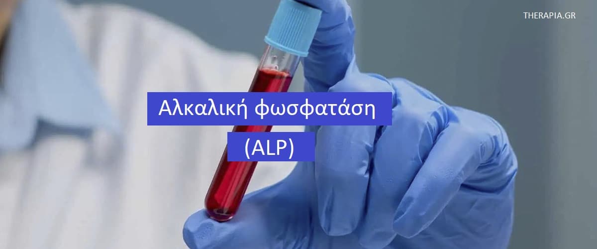 Αλκαλική φωσφατάση ALP, Εξέταση αλακαλικής φωσφατάσης, Πότε γίνεται η εξέταση αλκαλικής φωσφατάσης, Φυσιολογικές τιμές αλακαλικής φωσφατάσης, Υψηλές τιμές ALP, Χαμηλές τιμές ALP, Φάρμακα που επηρεάζουν τις τιμές της αλκαλικής φωσφατάσης