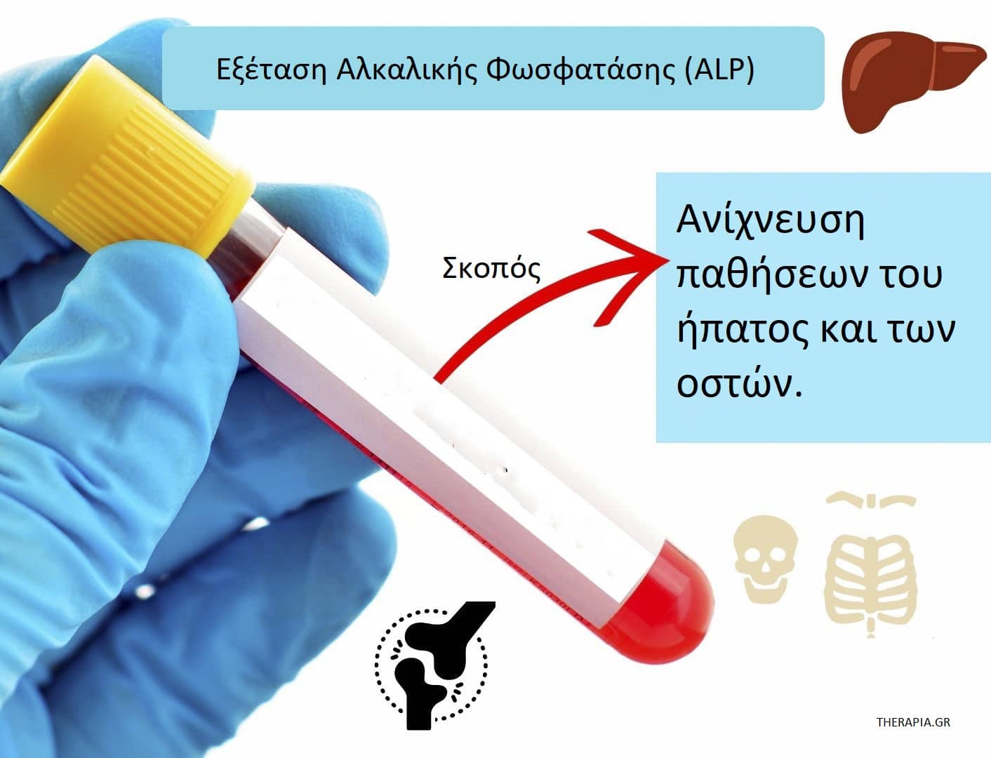 Αλκαλική φωσφατάση ALP, Προληπτικές εξετάσεις, Αιματολογικές εξετάσεις