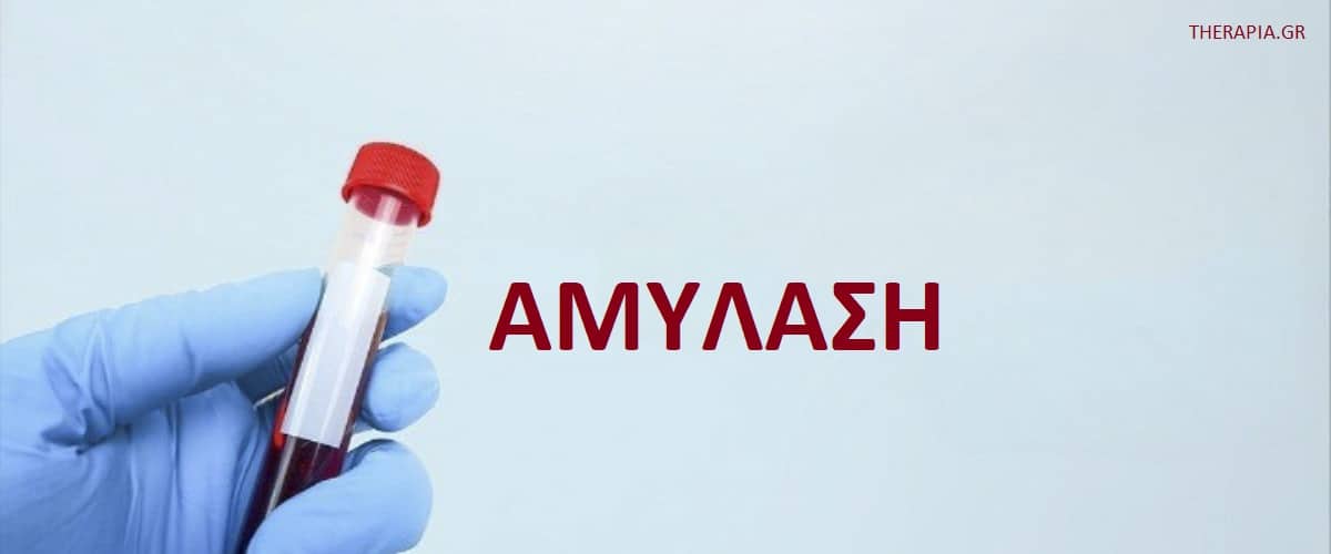 Αμυλάση, Εξέταση αμυλάσης, Πότε γίνεται η εξέταση αμυλάσης, Υψηλές τιμές αμυλάσης, Χαμηλές τιμές αμυλάσης, Λιπάση, Φάρμακα που επηρεάζουν την εξέταση αμυλάσης