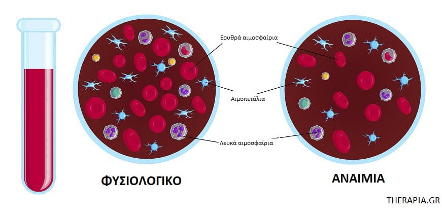Αναιμία, Εξετάσεις αίματος, Αιματοκρίτης