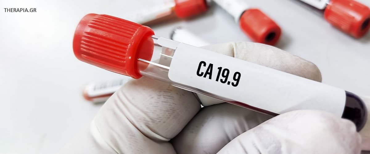 Εξέταση CA 19-9, Πως γίνεται η εξέταση CA 19-9, Πότε γίνεται η εξέταση CA 19-9, Φυσιολογικές τιμές CA 19-9, Υψηλές τιμές CA 19-9, Χαμηλές τιμές CA 19-9, Φάρμακα που επηρεάζουν την εξέταση CA 19-9