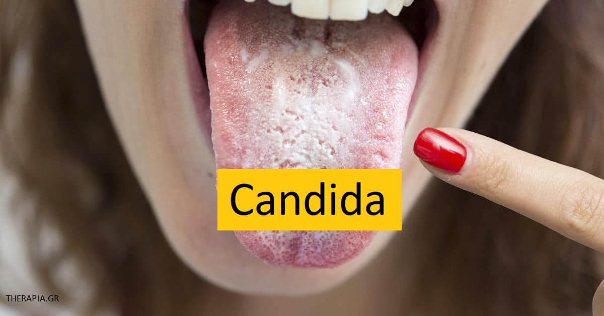 Candida, Μύκητες, Μυκητιάσεις
