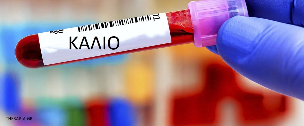 Κάλιο, Εξέταση καλίου, Πότε γίνεται εξέταση καλίου, Πως γίνεται η εξέταση καλίου, Υψηλές τιμές καλίου, Χαμηλές τιμές καλίου, Φάρμακα που επηρεάζουν την εξέταση καλίου