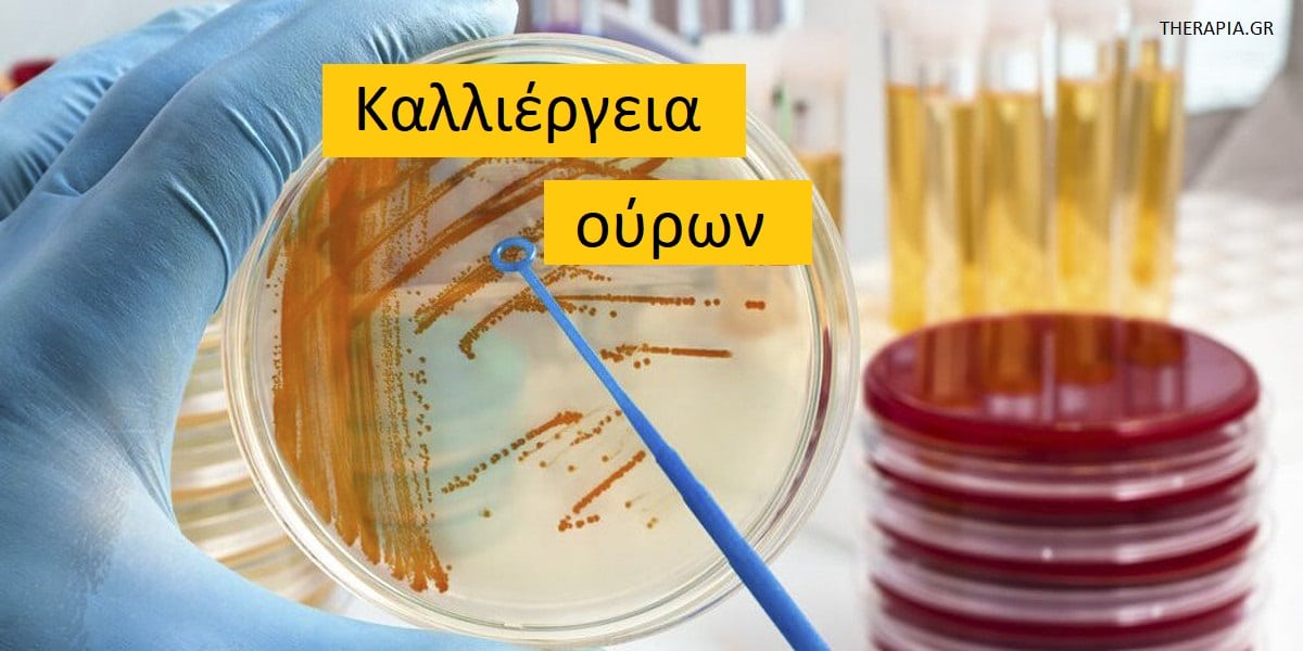 Καλλιέργεια ούρων, Τι δείχνει η καλλιέργεια ούρων, Πότε γίνεται η καλλιέργεια ούρων, Φυσιολογικά ευρήματα στην καλλιέργεια ούρων, Χαμηλές τιμές στην καλλιέργεια ούρων, Υψηλές τιμές στην καλλιέργεια ούρων, Φάρμακα που επηρεάζουν την καλλιέργεια ούρων