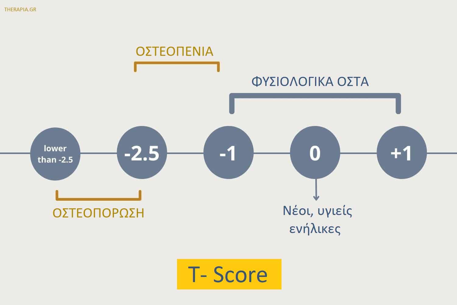 Οστεοπενία, Μέτρηση οστικής πυκνότητας, Εξετάσεις οστών
