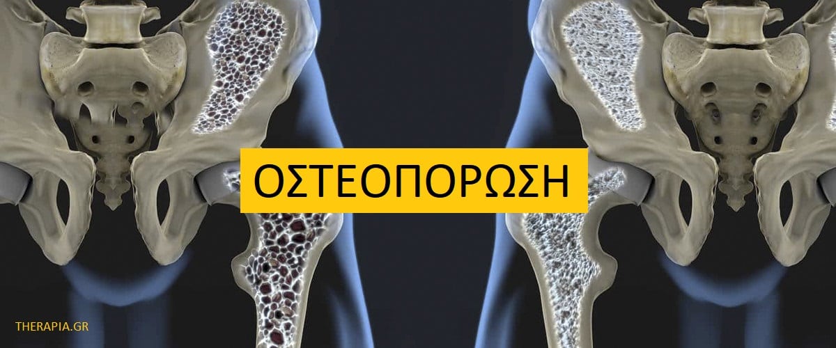 Οστεοπόρωση, Μέτρηση οστικής πυκνότητας, Φυσιολογικές τιμές οστικής πυκνότητας, Υψηλές τιμές οστικής πυκνότητας, χαμηλές τιμές οστικής πυκνότητας, Φάρμακα που επηρεάζουν την πυκνότητα των οστών
