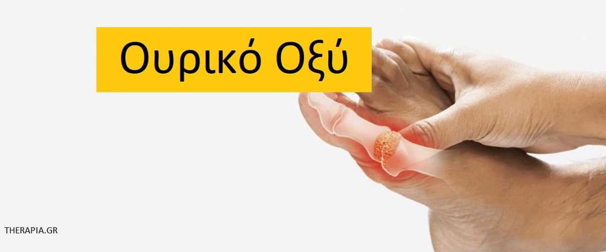 Ουρικό οξύ, Εξέταση ουρικού οξέος, Πότε γίνεται η εξέταση ουρικού οξέος, Πως γίνεται η εξέταση ουρικού οξέος, Φυσιολογικές τιμές ουρικού οξέος, Υψηλές τιμές ουρικού οξέος, Χαμηλές τιμές ουρικού οξέος, Φάρμακα που επηρεάζουν την εξέταση ουρικού οξέος