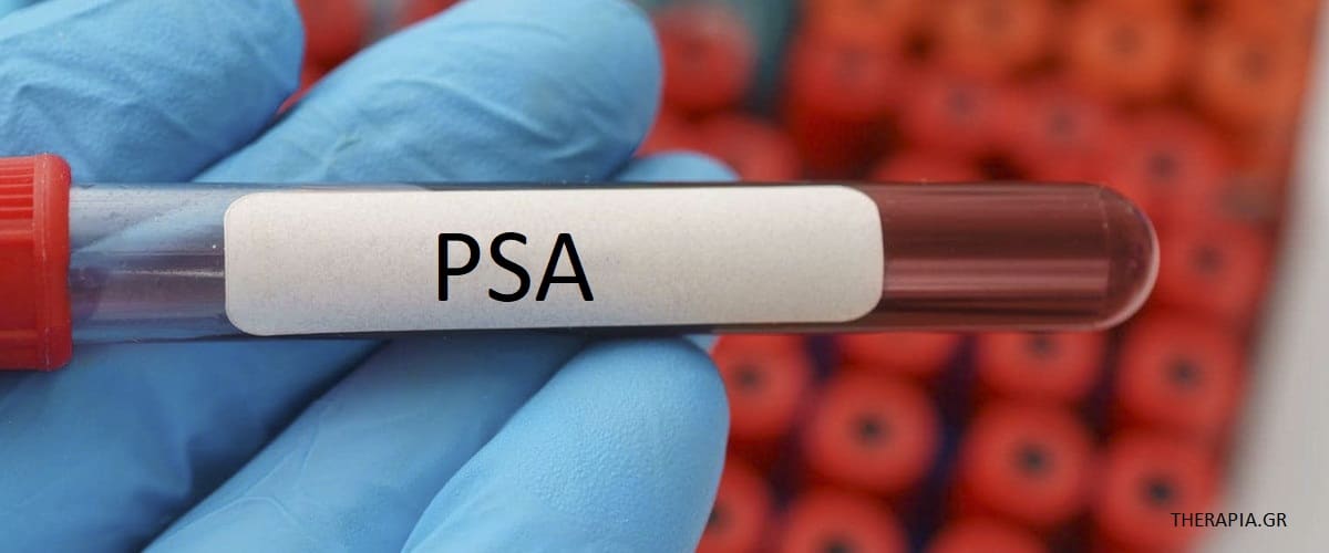 PSA, Ειδικό Προστατικό Αντιγόνο, Εξέταση PSA, Φυσιολογικές τιμές PSA, Υψηλές τιμές PSA, Χαμηλές τιμές PSA, Προστάτης, Φάρμακα που επηρεάζουν την εξέταση PSA