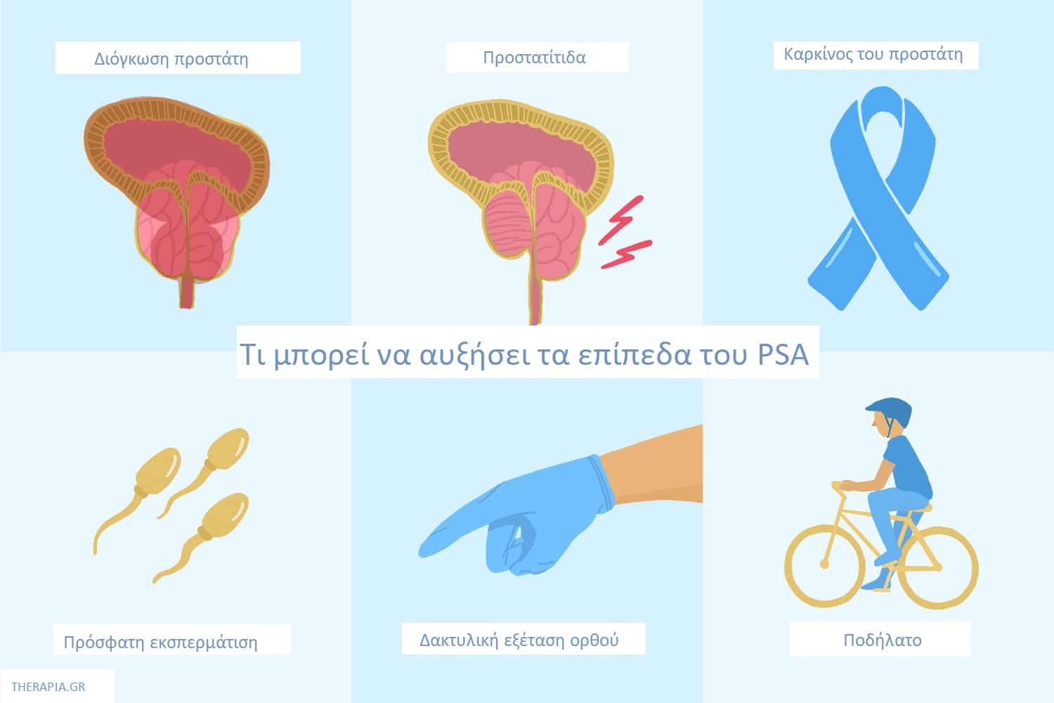 PSA, Προστάτης, Εξετάσεις