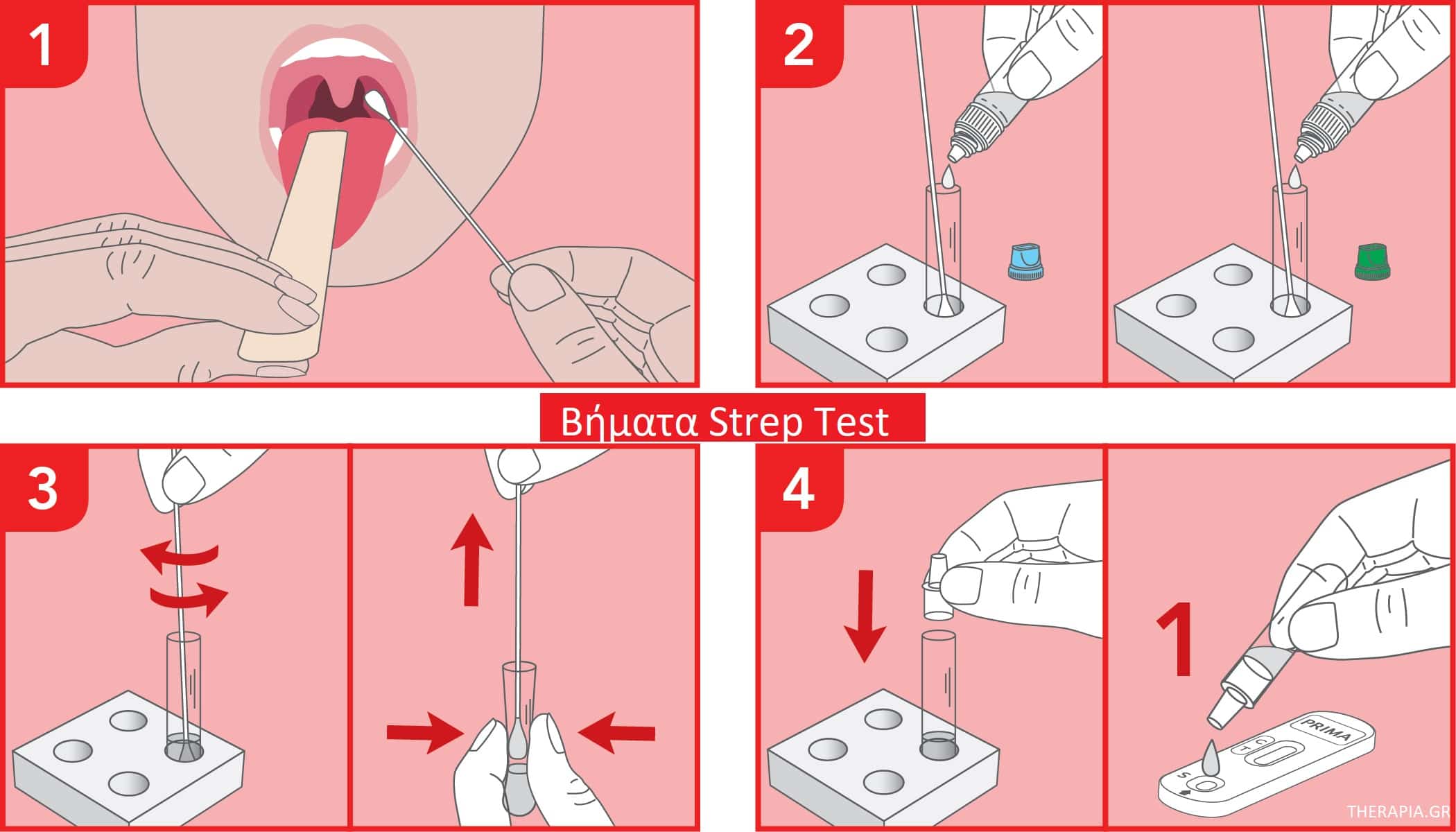 Strep test, Στρεπτόκοκκος, Αποτελέσματα strep test