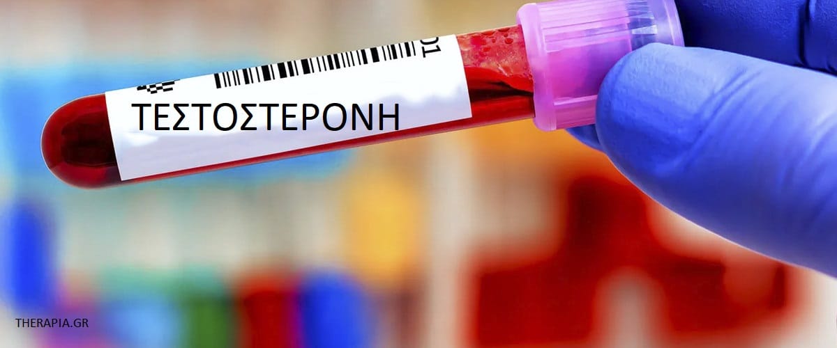Τεστοστερόνη, Εξέταση τεστοστερόνης, Πως γίνεται η εξέταση τεστοστερόνης, Πότε γίνεται η εξέταση τεστοστερόνης, Φυσιολογικές τιμές τεστοστερόνης, Υψηλές τιμές τεστοστερόνης, Χαμηλές τιμές τεστοστερόνης, Φάρμακα που επηρεάζουν την εξέταση τεστοστερόνης