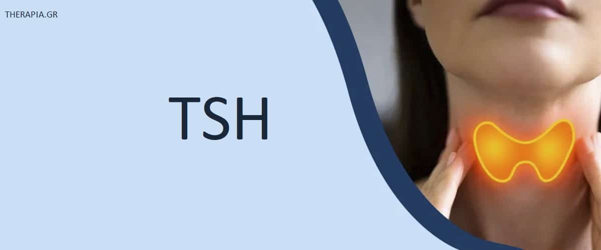 TSH, Εξέταση TSH, Θυροειδής, Πότε γίνεται η εξέταση TSH, Πως γίνεται η εξέταση TSH, Φυσιολογικές τιμές TSH, Υψηλές τιμές TSH, Χαμηλές τιμές TSH, Φάρμακα που επηρεάζουν την εξέταση TSH
