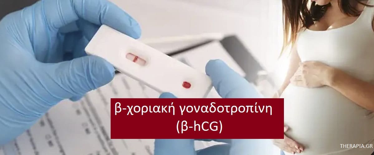 Β-χοριακή γοναδοτροπίνη β-hCG, Εξέταση β-χοριακής γοναδοτροπίνης, Πότε γίνεται η εξέταση β-χοριακής, Πως γίνεται η εξέταση β-χοριακηής, Υψηλές τιμές β-χοριακής γοναδοτροπίνης, Χαμηλές τιμές β-χοριακής γοναδοτροπίνης, Φάρμακα που επηρεάζουν την εξέταση β-χοριακής, Β-χοριακή και εγκυμοσύνη