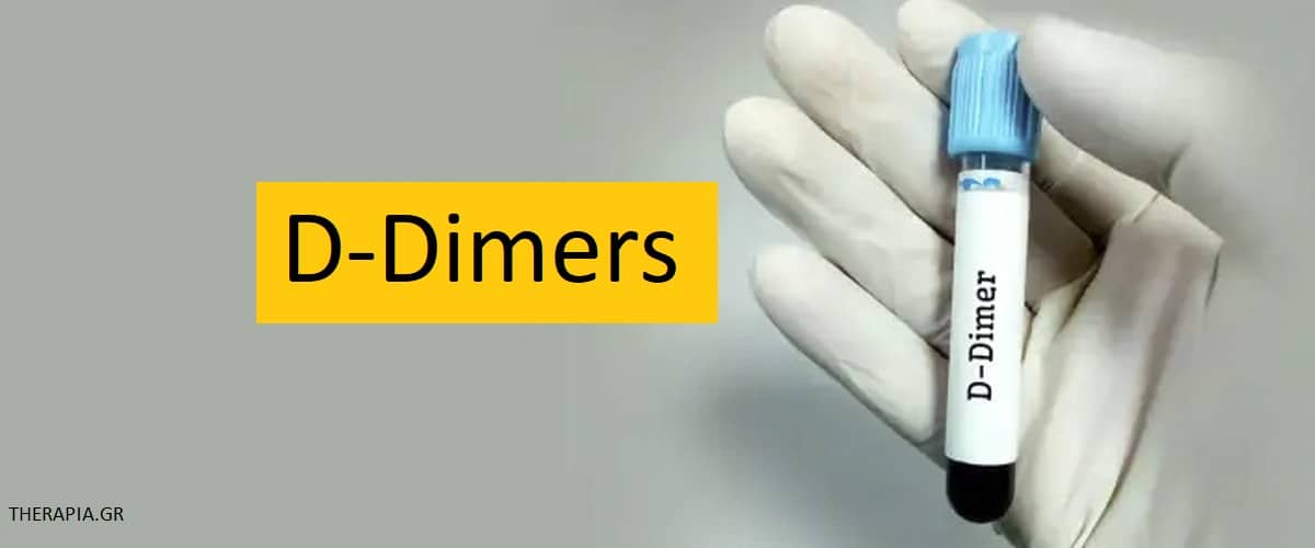 D-Dimers εξέταση, Πότε γίνεται η εξέταση d-dimers, Φυσιολογικές τιμές d-dimers, Υψηλές τιμές d-dimers, Χαμηλές τιμές d-dimers, Φάρμακα που επηρεάζουν την εξέταση d-dimers