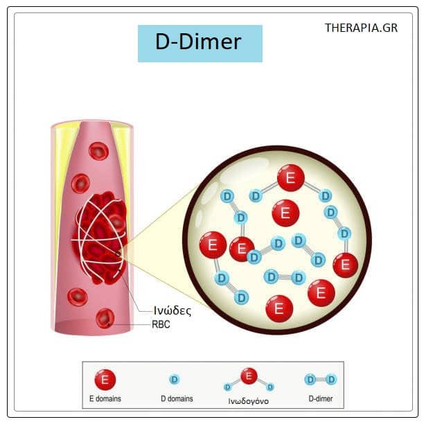 D-dimers, Εξετάσεις αίματος, Θρόμβωση