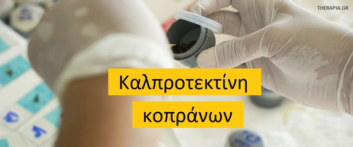Καλπροτεκτίνη κοπάνων, Εξετάσεις κοπράνων, Φλεγμονή στο έντερο, Φυσιολογικές τιμές καλπροτεκτίνης κοπράνων, Υψηλές τιμές καλπροτεκτίνης κοπράνων, Χαμηλές τιμές καλπροτεκτίνης κοπράνων, Εξετάσεις κοπράνων, Φάρμακα που επηρεάζουν την εξέταση καλπροτεκτίνης κοπράνων