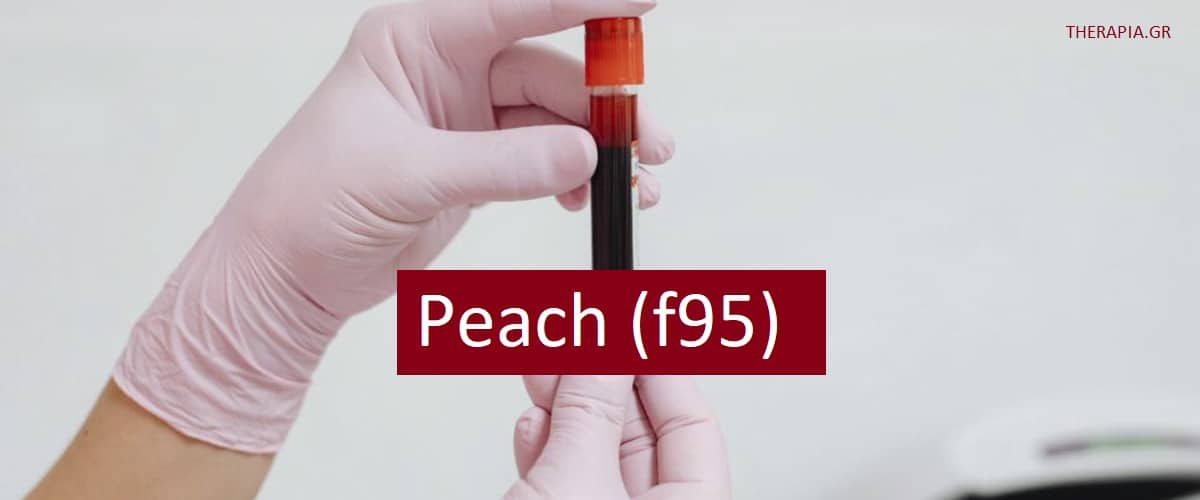 Peach (f95), Εξέταση για αλλεργία, Εξέταση για IgE, Αλλεργία στα ροδάκινα, Πότε γίνεται η εξέταση peach (f95), Υψηλές τιμές peach (f95), Χαμηλές τιμές peach (f95)