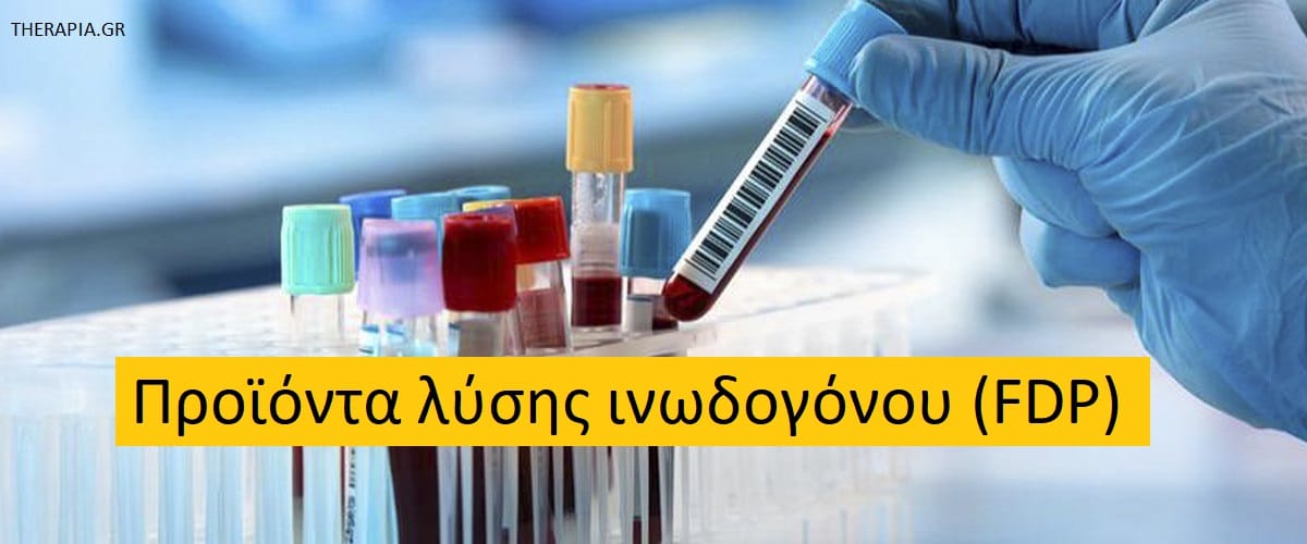 Προϊόντα λύσης ινωδογόνου FDP, Εξέταση FDP, Πότε γίνεται η εξέταση FDP, Υψηλές τιμές FDP. Χαμηλές τιμές FDP, Φάρμακα που επηρεάζουν την εξέταση FDP