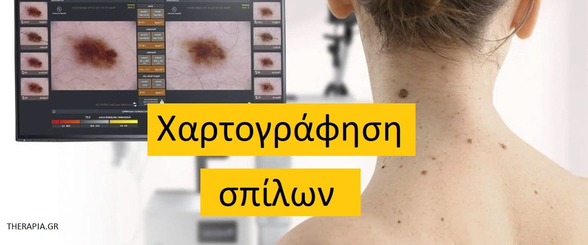 Χαρτογράφηση σπίλων, Εξέταση για σπίλους, Φυσιολογικά ευρήματα στη χαρτογράφηση σπίλων, Ευρήματα στη χαρτογράφηση σπίλων, Φάρμακα πο επηρεάζουν τη εξέταση για τους σπίλους
