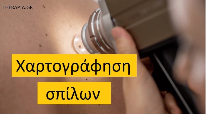Χαρτογράφηση σπίλων, Εξετάσεις για τους σπίλους, Ευρήματα στη χαρτογράφηση σπίλων
